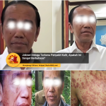 Jokowi terlihat alami alergi kulit ringan saat kunjungan kerja di luar kota